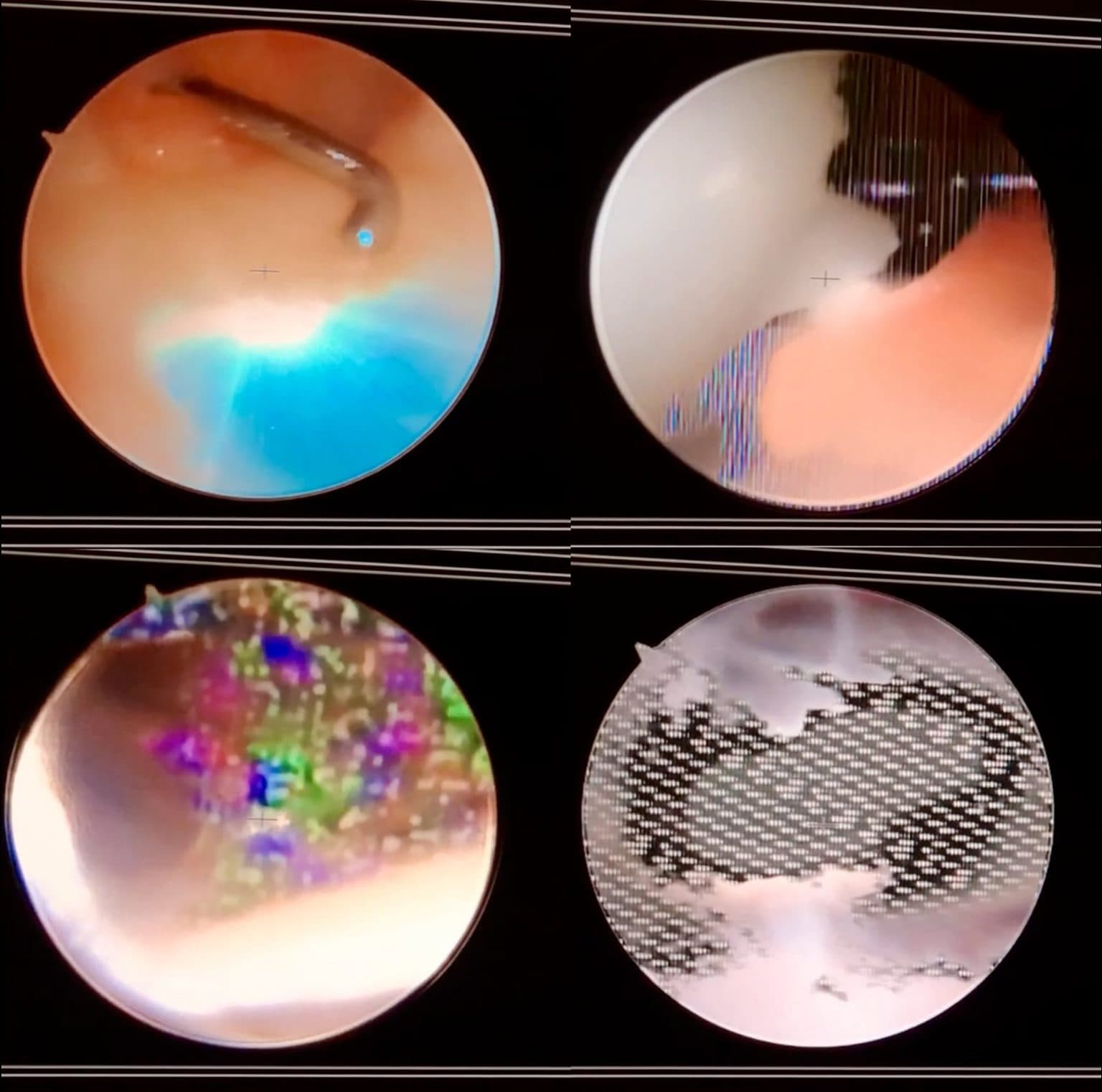 VJ Conference: Excision